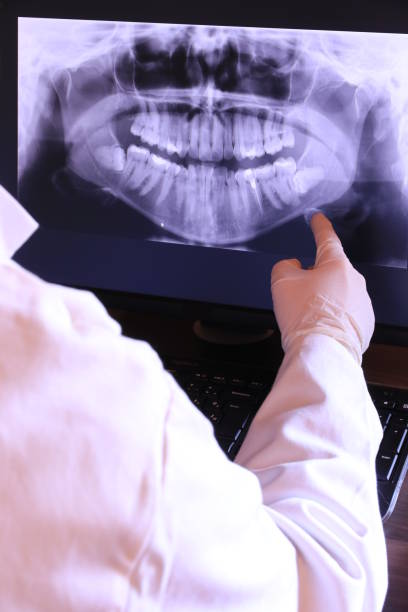 Best Emergency Dentist for Lost Fillings or Crowns in University Heights, IA